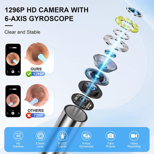 ClearLobe HD Ear Camera Cleaner – live view on your phone